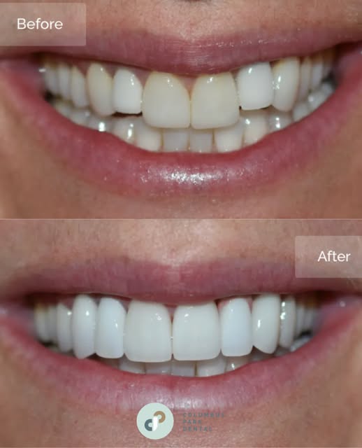 Before and after cosmetic treatment — Instagram post