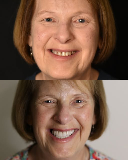 Patient smile transformation — Instagram post